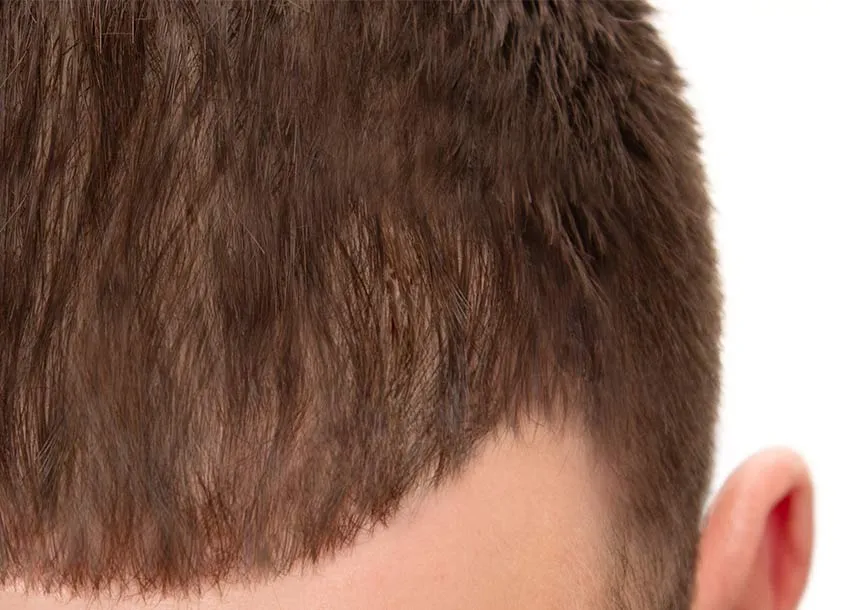 GFC Hair Growth Treatment Men