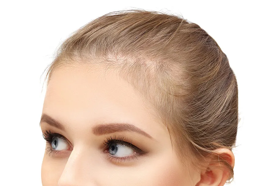 GFC Hair Growth Treatment For Women
