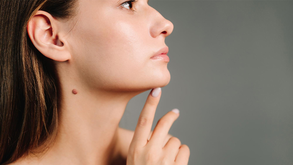 Mole Removal Treatment