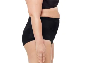 Before Hip Fat Reduction Treatment