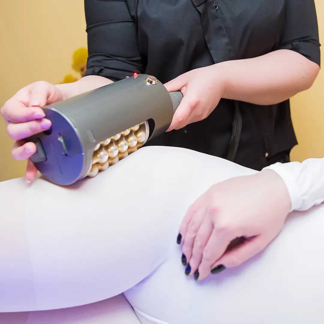 Hip Fat Reduction Service