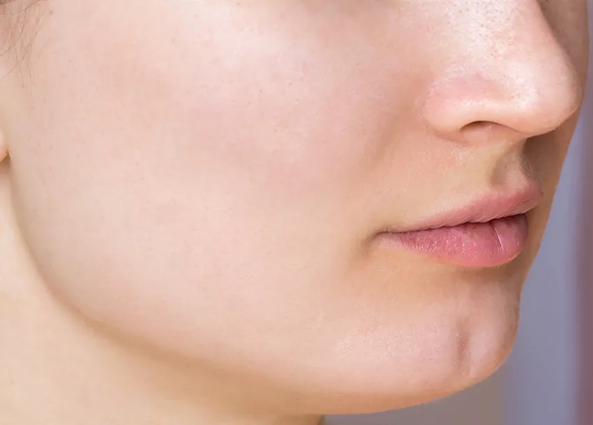 Acne Spot Removal