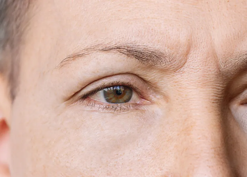 Get Anti-Oxidant Treatment to Improve Skin