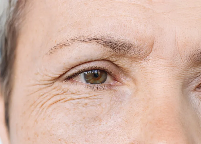 Get Anti-Oxidant Treatment to Improve Skin