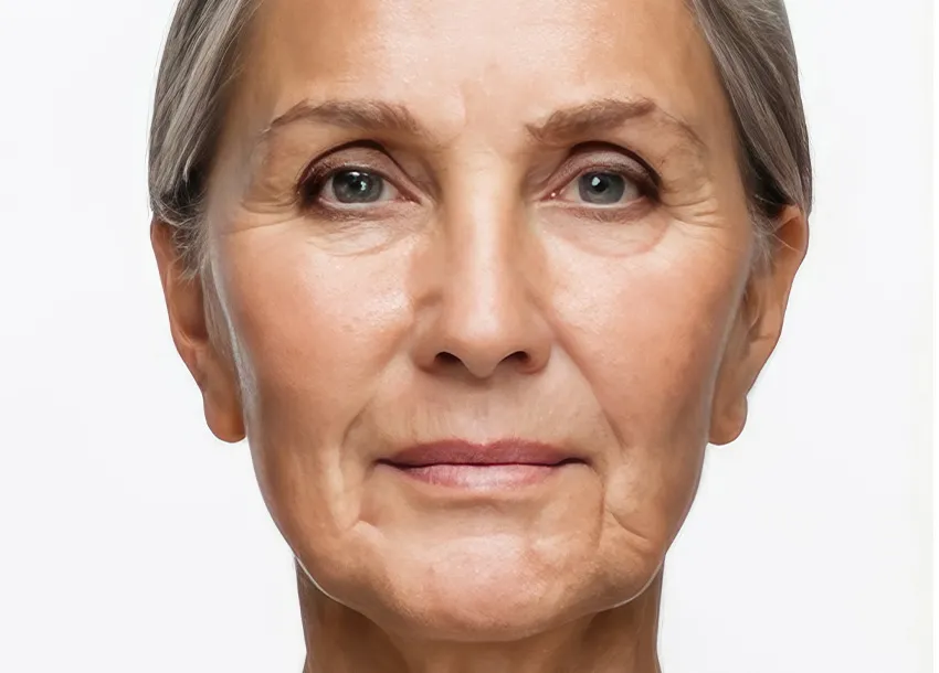 Skin Whitening Injection Service