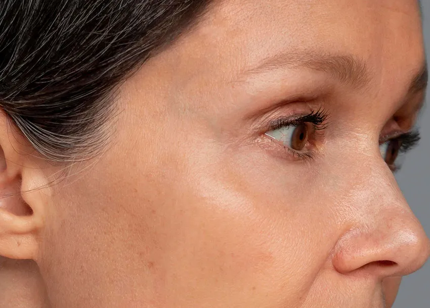 Anti-Oxidant Treatment Benefits