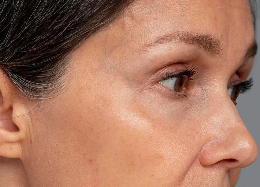 Anti-Oxidant Treatment Benefits