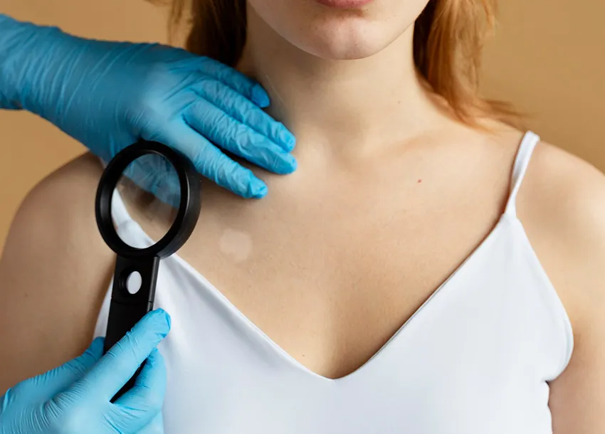 Achil Remove Benefits: spotless and even-tone skin