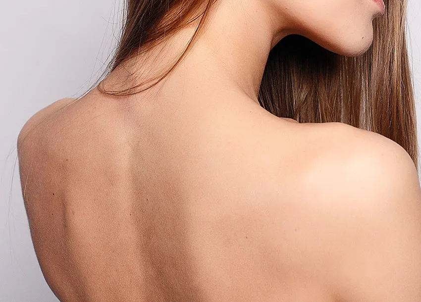 Best Mole Remove Treatment in Dhaka: no scarring