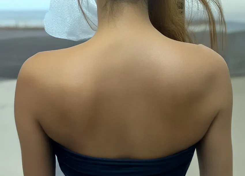 Ink Tattoo Remove Treatment in Dhaka